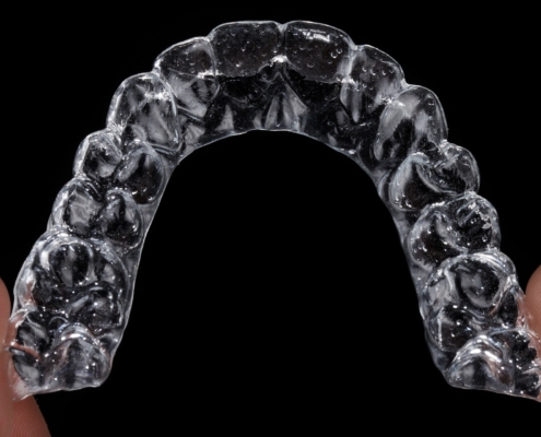 Bruxismus invisalign